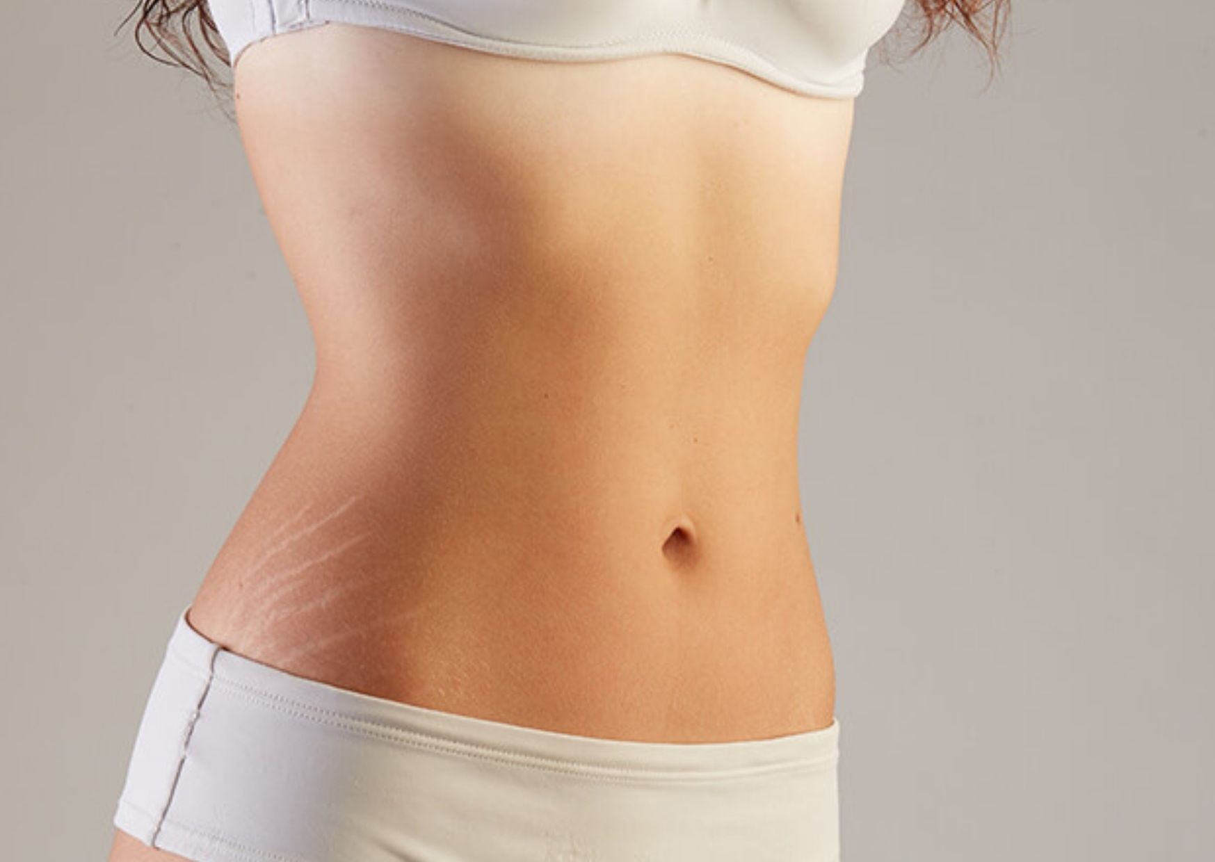 prevents stretch marks