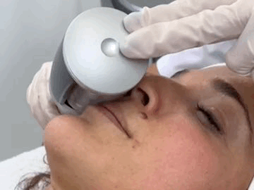 endospheres-therapy-face