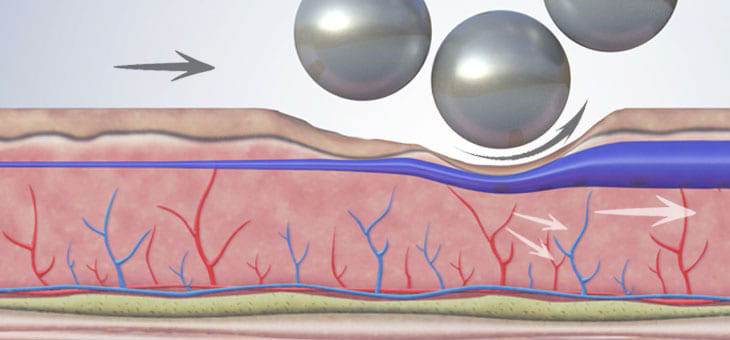 endospheres-deep-drainage