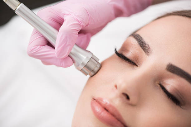Close up of instrument in hand of doctor-cosmetologist, which is making procedure microdermabrasion of facial skin