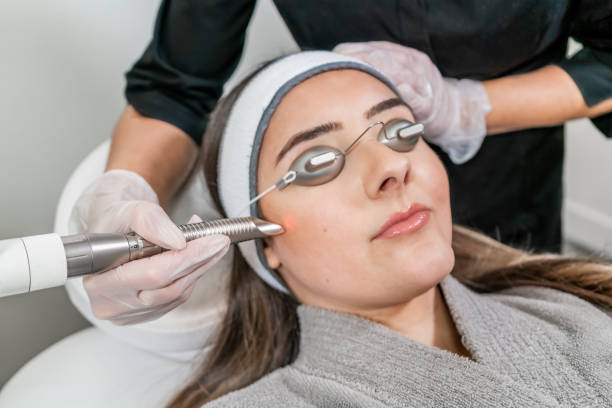 Beauty laser technician performing a cosmetic skin resurfacing session on a female patient, also called a laser peel or photofacial