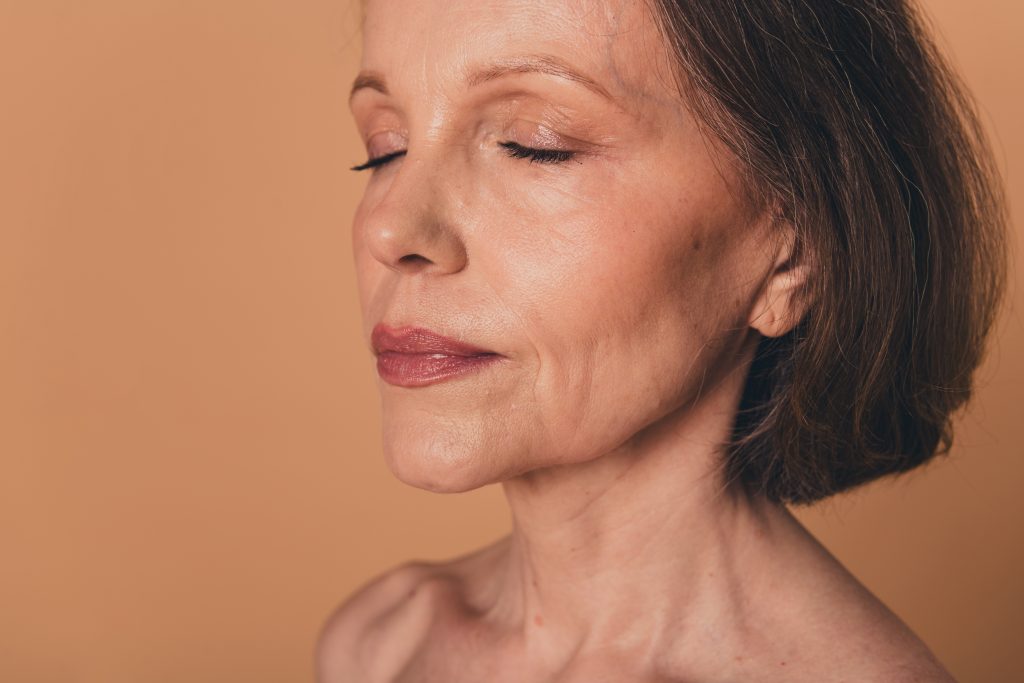 arrugas del surco nasogeniano